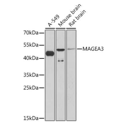 Western Blot - Anti-MAGE3 Antibody (A93092) - Antibodies.com