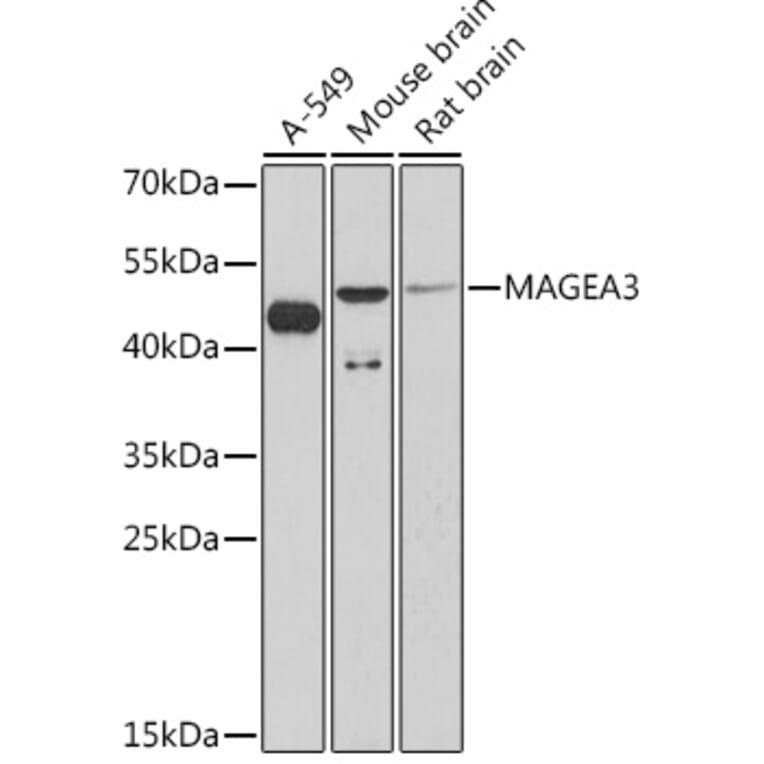 Western Blot - Anti-MAGE3 Antibody (A93092) - Antibodies.com