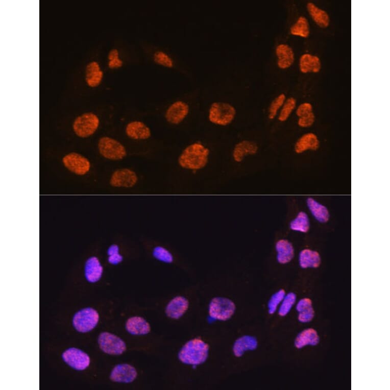 Immunofluorescence - Anti-MAML2 Antibody (A93093) - Antibodies.com