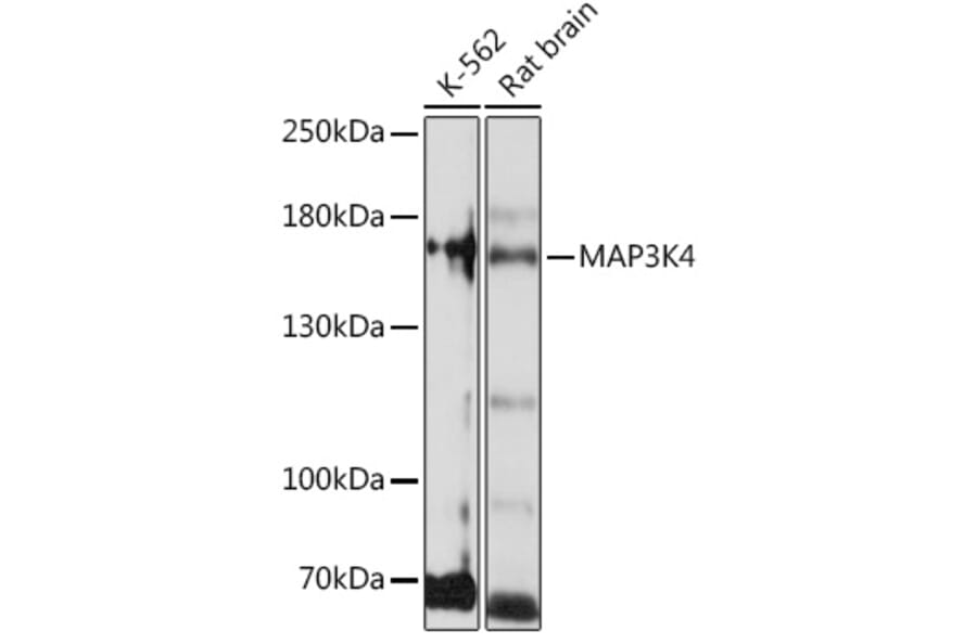 Western Blot - Anti-MAP3K4 Antibody (A93094) - Antibodies.com