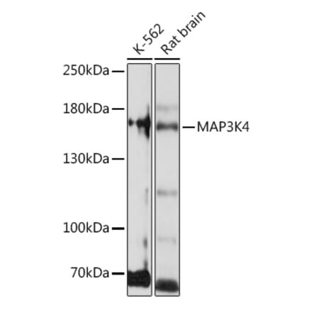 Western Blot - Anti-MAP3K4 Antibody (A93094) - Antibodies.com