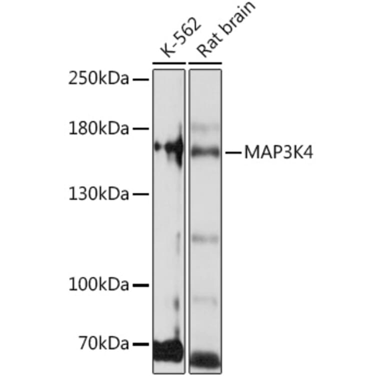 Western Blot - Anti-MAP3K4 Antibody (A93094) - Antibodies.com