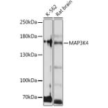 Western Blot - Anti-MAP3K4 Antibody (A93094) - Antibodies.com