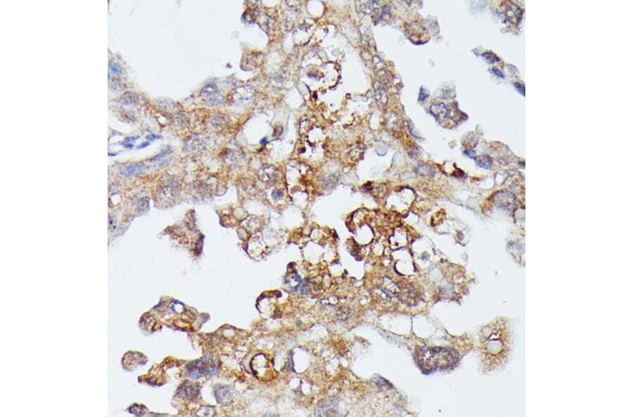 Immunohistochemistry - Anti-MAP3K4 Antibody (A93094) - Antibodies.com
