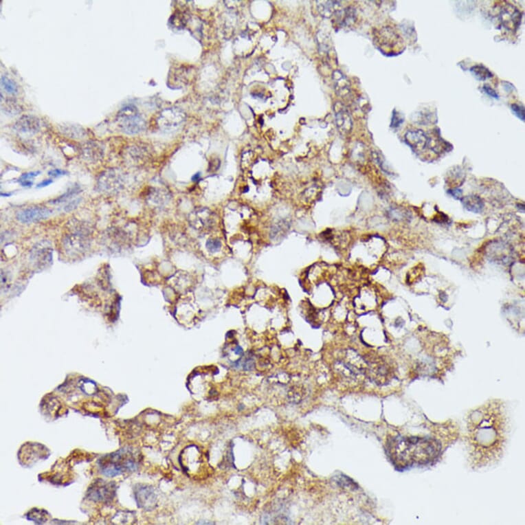Immunohistochemistry - Anti-MAP3K4 Antibody (A93094) - Antibodies.com