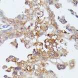 Immunohistochemistry - Anti-MAP3K4 Antibody (A93094) - Antibodies.com
