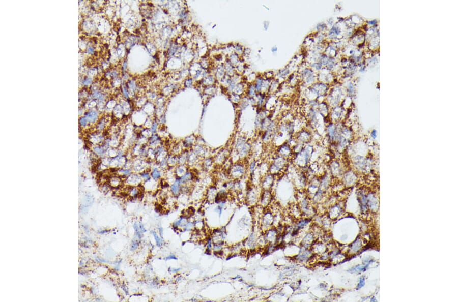 Immunohistochemistry - Anti-MAP3K4 Antibody (A93094) - Antibodies.com