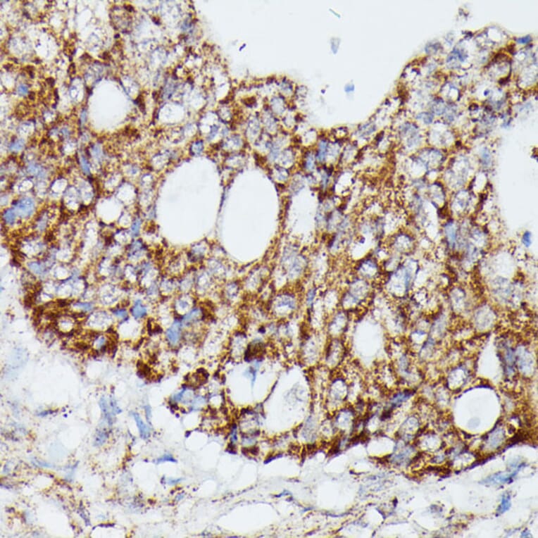 Immunohistochemistry - Anti-MAP3K4 Antibody (A93094) - Antibodies.com