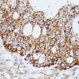 Immunohistochemistry - Anti-MAP3K4 Antibody (A93094) - Antibodies.com