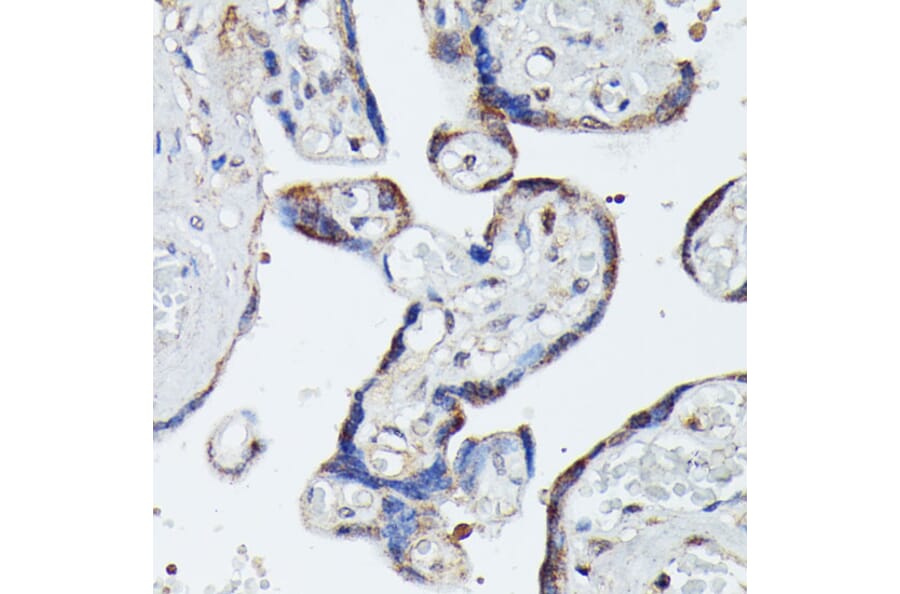 Immunohistochemistry - Anti-MAP3K4 Antibody (A93094) - Antibodies.com