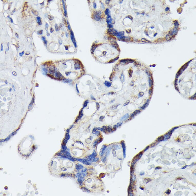 Immunohistochemistry - Anti-MAP3K4 Antibody (A93094) - Antibodies.com