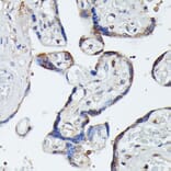 Immunohistochemistry - Anti-MAP3K4 Antibody (A93094) - Antibodies.com