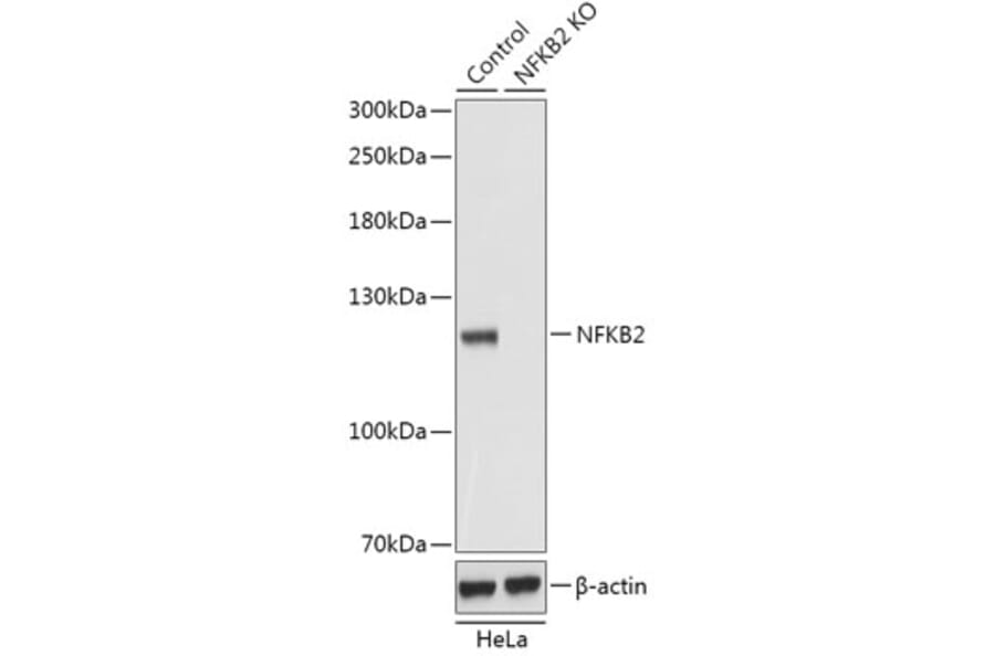 Western Blot - Anti-NFkB p100 / NFKB2 Antibody (A93099) - Antibodies.com