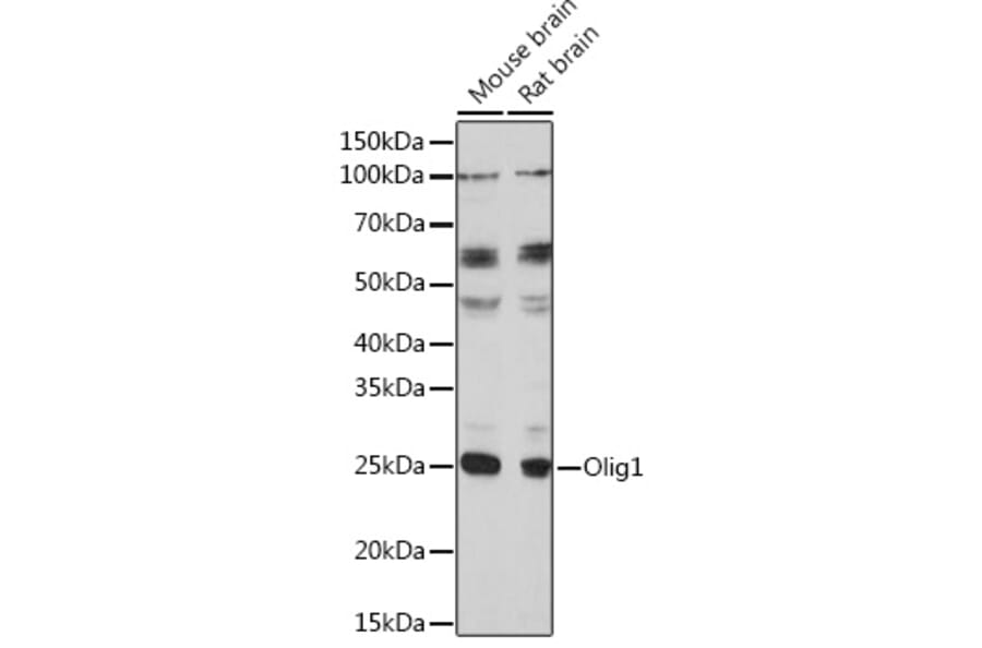 Western Blot - Anti-Olig1 Antibody (A93102) - Antibodies.com
