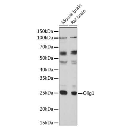 Western Blot - Anti-Olig1 Antibody (A93102) - Antibodies.com