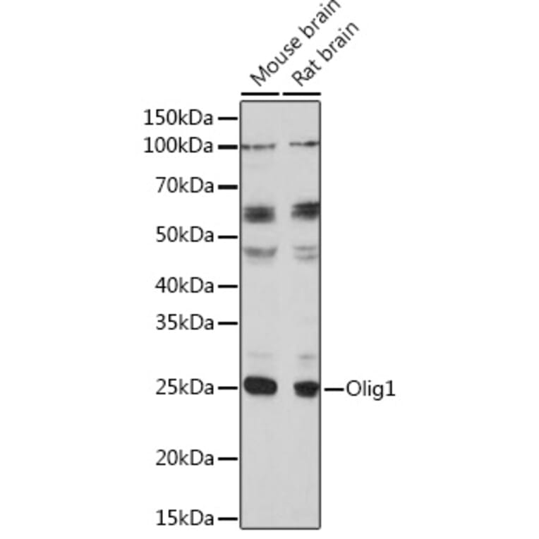 Western Blot - Anti-Olig1 Antibody (A93102) - Antibodies.com