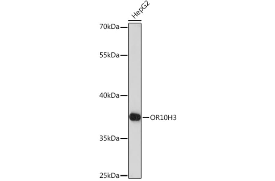 Western Blot - Anti-OR10H3 Antibody (A93104) - Antibodies.com