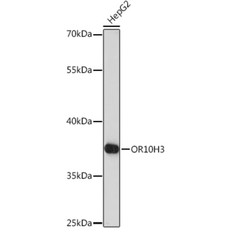Western Blot - Anti-OR10H3 Antibody (A93104) - Antibodies.com