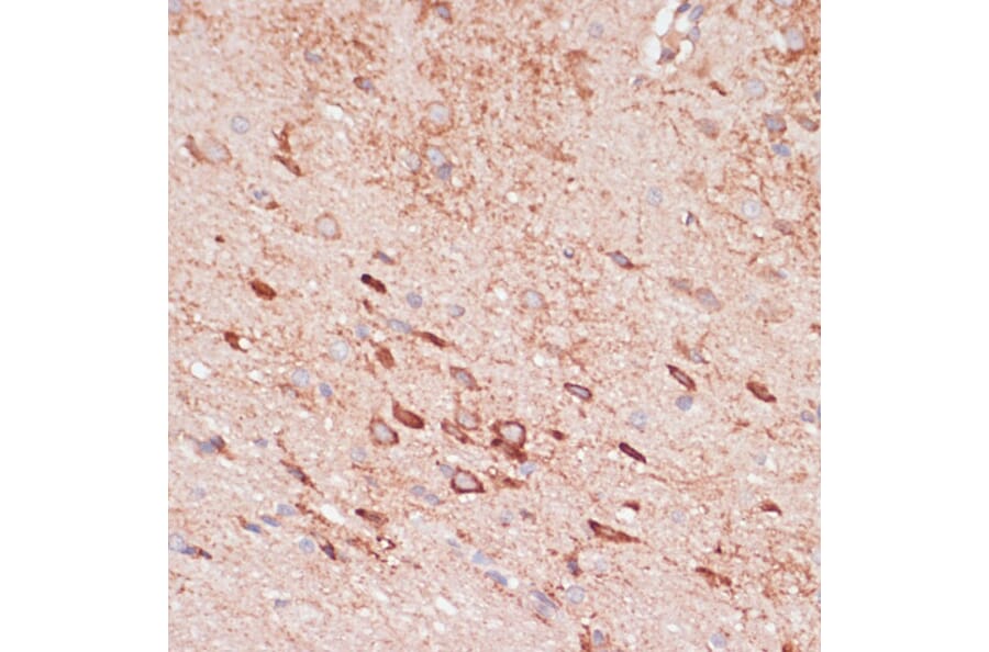 Immunohistochemistry - Anti-OR10H3 Antibody (A93104) - Antibodies.com