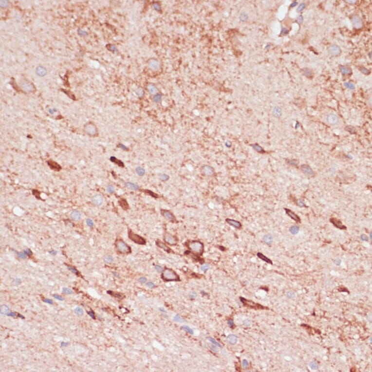 Immunohistochemistry - Anti-OR10H3 Antibody (A93104) - Antibodies.com