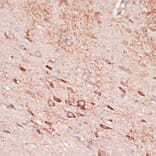 Immunohistochemistry - Anti-OR10H3 Antibody (A93104) - Antibodies.com