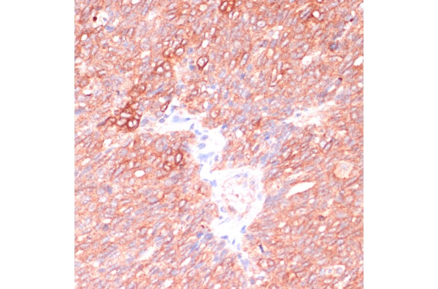 Immunohistochemistry - Anti-OR10H3 Antibody (A93104) - Antibodies.com