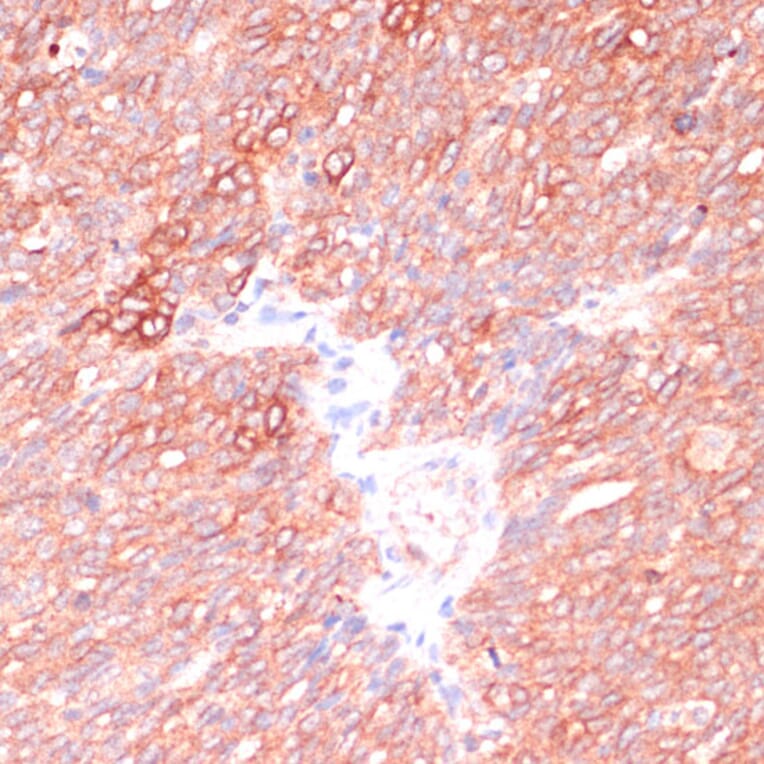 Immunohistochemistry - Anti-OR10H3 Antibody (A93104) - Antibodies.com