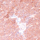 Immunohistochemistry - Anti-OR10H3 Antibody (A93104) - Antibodies.com