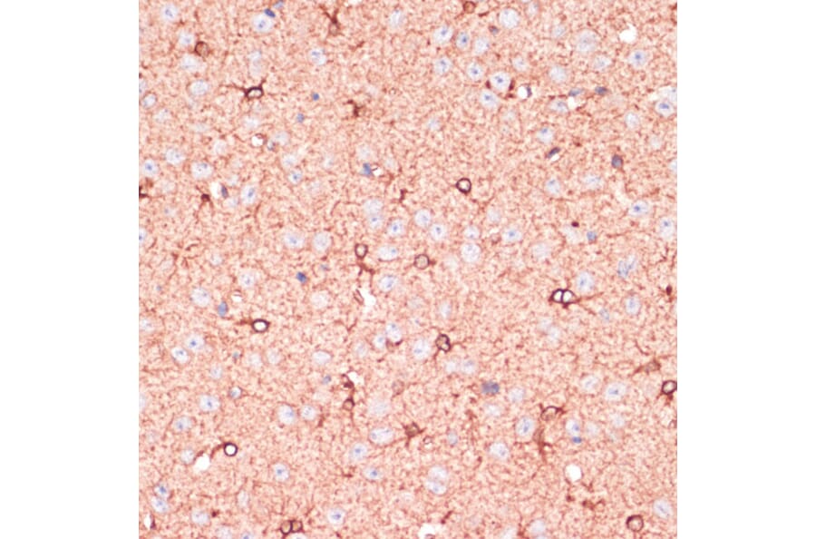 Immunohistochemistry - Anti-OR10H3 Antibody (A93104) - Antibodies.com