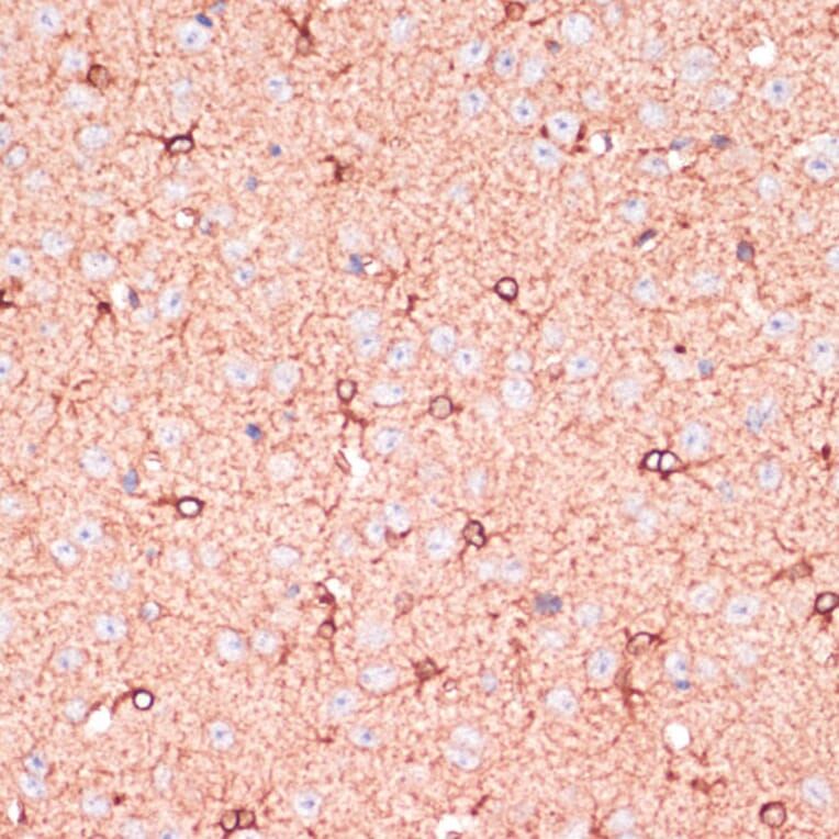 Immunohistochemistry - Anti-OR10H3 Antibody (A93104) - Antibodies.com