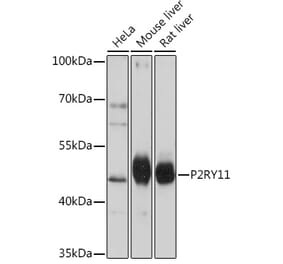 Western Blot - Anti-P2Y11 Antibody (A93106) - Antibodies.com