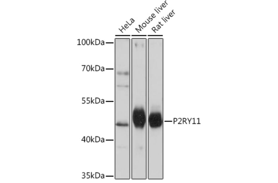 Western Blot - Anti-P2Y11 Antibody (A93106) - Antibodies.com