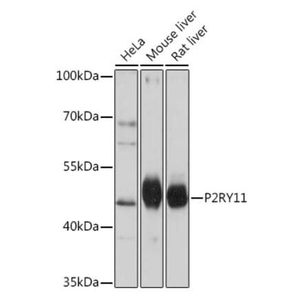 Western Blot - Anti-P2Y11 Antibody (A93106) - Antibodies.com
