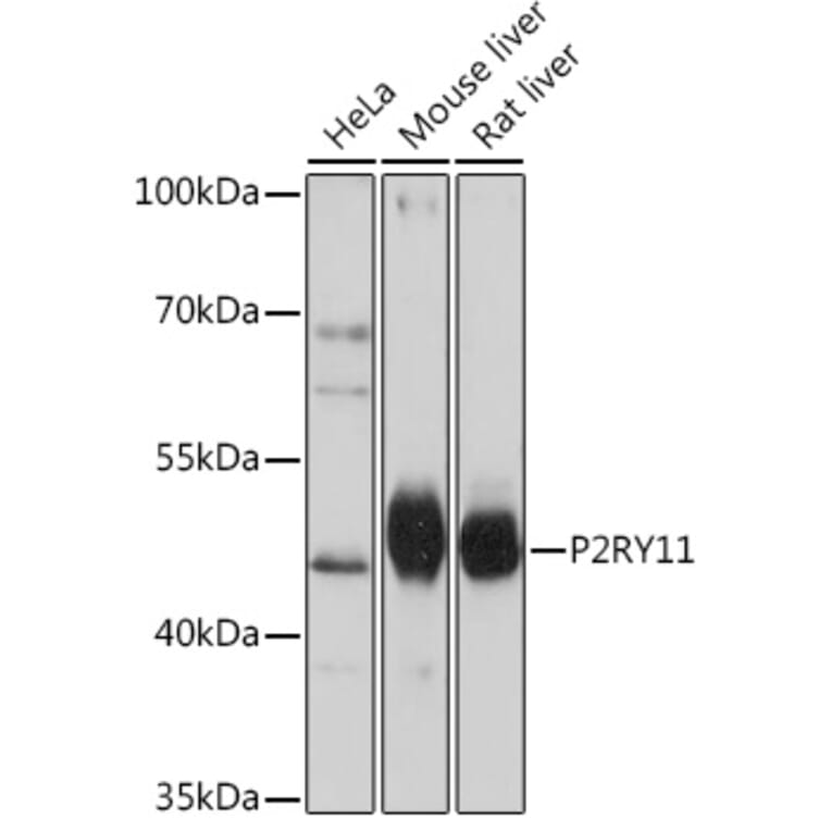 Western Blot - Anti-P2Y11 Antibody (A93106) - Antibodies.com