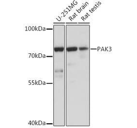 Western Blot - Anti-PAK3 Antibody (A93107) - Antibodies.com