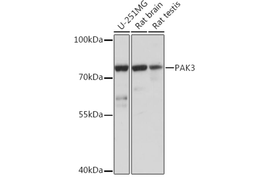 Western Blot - Anti-PAK3 Antibody (A93107) - Antibodies.com