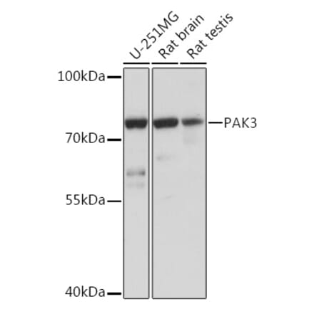 Western Blot - Anti-PAK3 Antibody (A93107) - Antibodies.com