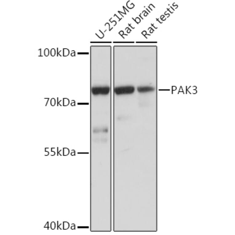 Western Blot - Anti-PAK3 Antibody (A93107) - Antibodies.com