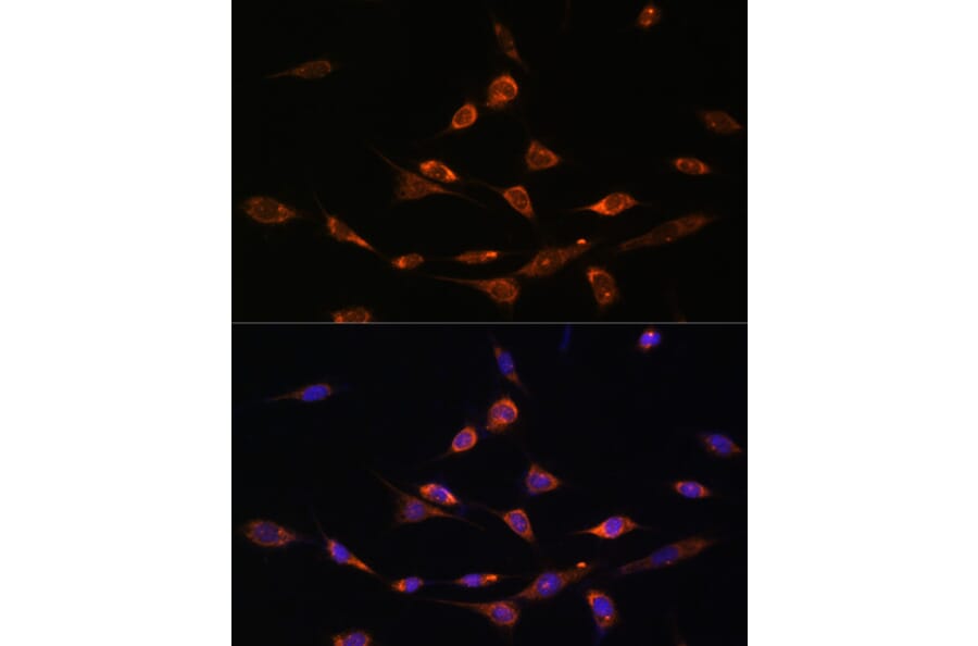 Immunofluorescence - Anti-PAK3 Antibody (A93107) - Antibodies.com