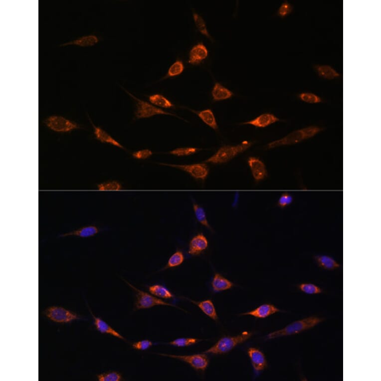 Immunofluorescence - Anti-PAK3 Antibody (A93107) - Antibodies.com