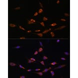 Immunofluorescence - Anti-PAK3 Antibody (A93107) - Antibodies.com