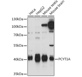 Western Blot - Anti-CT A Antibody (A93109) - Antibodies.com