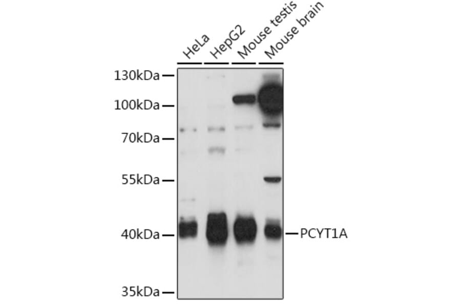 Western Blot - Anti-CT A Antibody (A93109) - Antibodies.com
