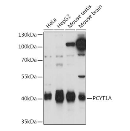 Western Blot - Anti-CT A Antibody (A93109) - Antibodies.com