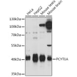 Western Blot - Anti-CT A Antibody (A93109) - Antibodies.com