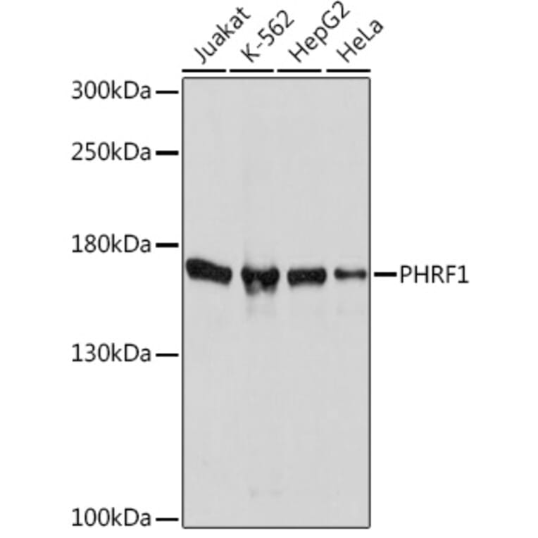 Western Blot - Anti-PHRF1 Antibody (A93110) - Antibodies.com