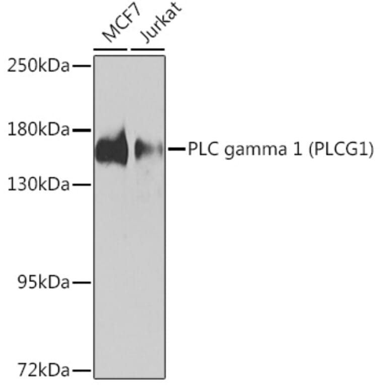 Western Blot - Anti-Phospholipase C gamma 1 / PLC-gamma-1 Antibody (A93112) - Antibodies.com
