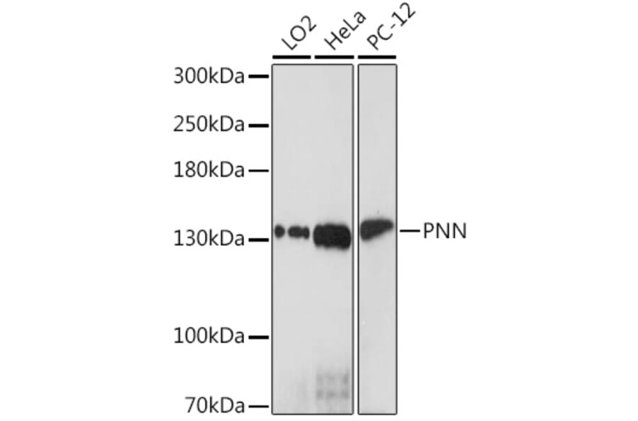 Western Blot - Anti-PNN/DRSP Antibody (A93113) - Antibodies.com