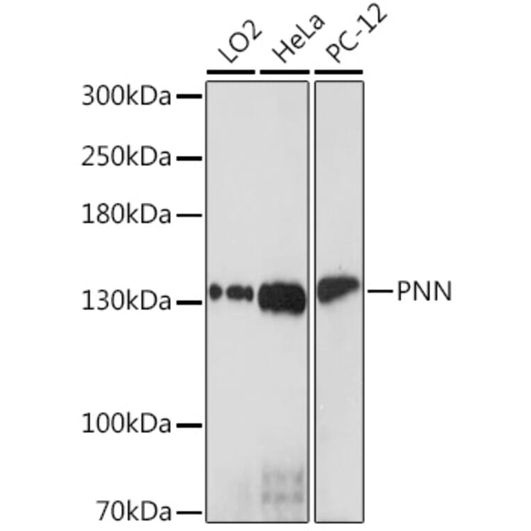 Western Blot - Anti-PNN/DRSP Antibody (A93113) - Antibodies.com