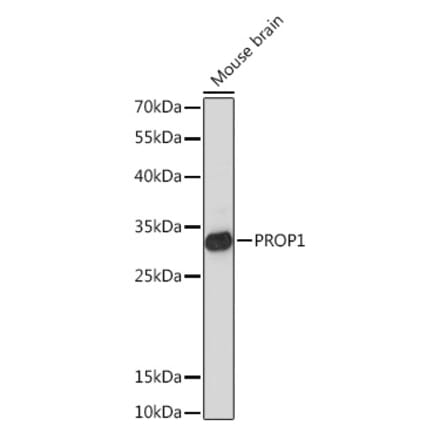Western Blot - Anti-PROP1 Antibody (A93116) - Antibodies.com